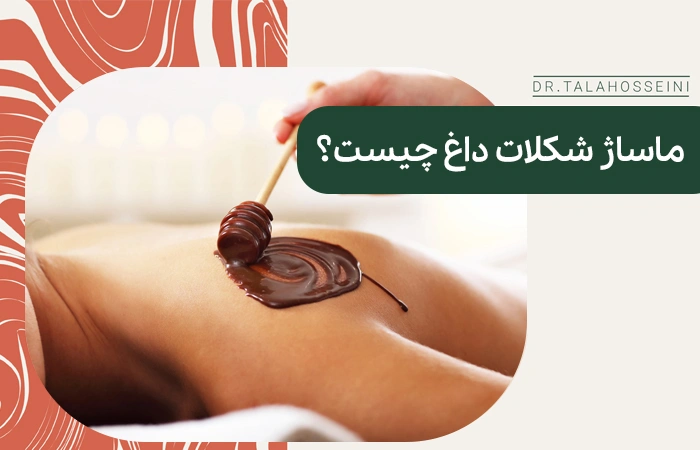 ماساژ با شکلات داغ