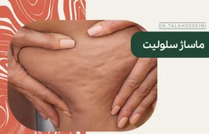ماساژ سلولیت